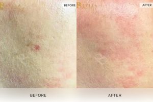 Lumps and Bumps 03 - 4