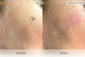 Lumps and Bumps 07 - 8