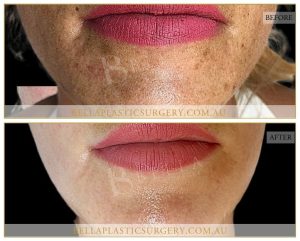 Skin Treatment 03 - 3
