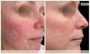 Skin Treatment 01 - 1