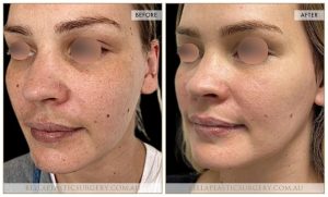 Skin Treatment 02 - 2